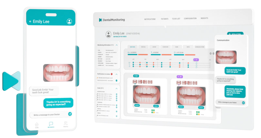 Interface do software DentalMonitoring